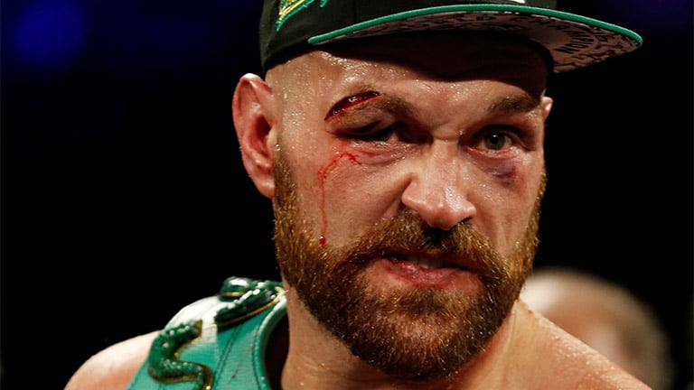 Tyson Fury